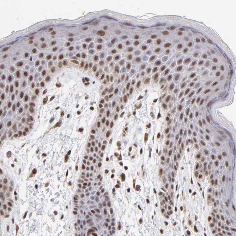DSN1 Antibody - BSA Free Immunohistochemistry-Paraffin: DSN1 Antibody - BSA Free [NBP1-88302]