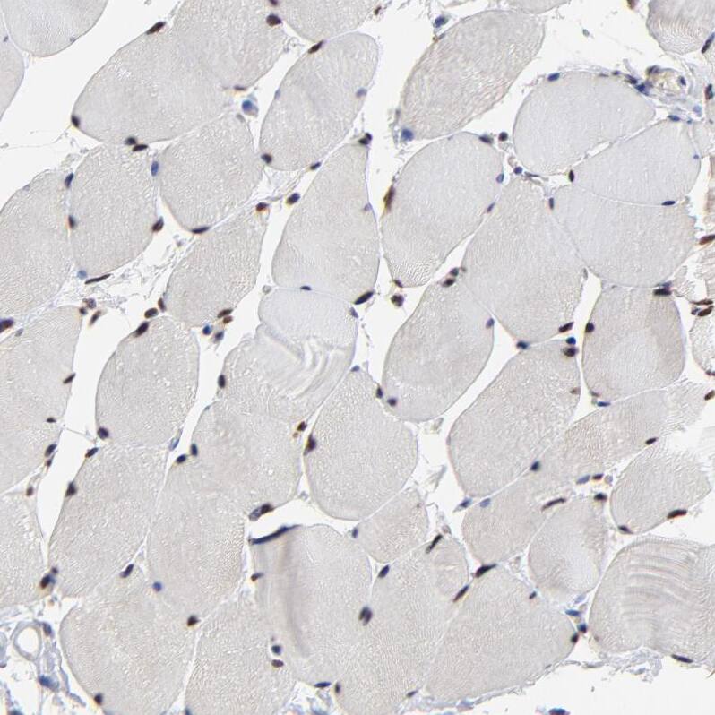 DSN1 Antibody - BSA Free Immunohistochemistry-Paraffin: DSN1 Antibody - BSA Free [NBP1-88302]