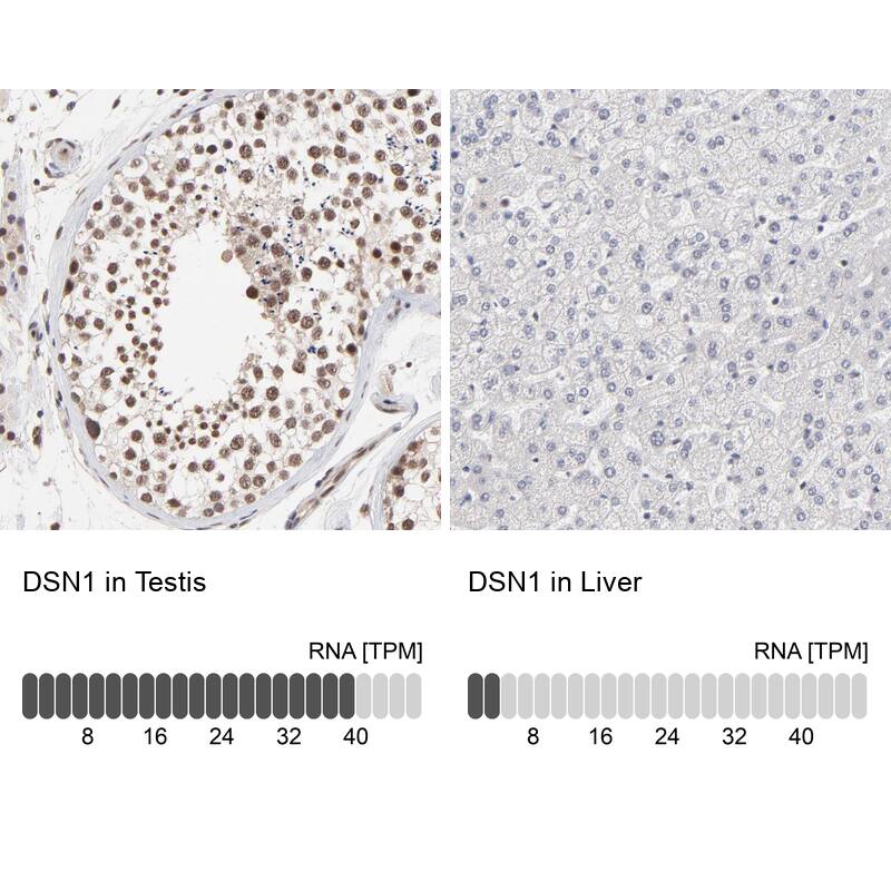 DSN1 Antibody - BSA Free Immunohistochemistry-Paraffin: DSN1 Antibody - BSA Free [NBP1-88302]