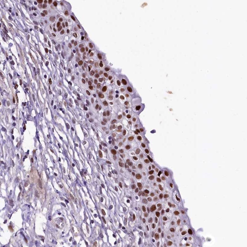SAMD10 Antibody - BSA Free Immunohistochemistry-Paraffin: SAMD10 Antibody [NBP1-88305]