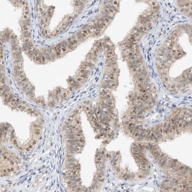 TASP1 Antibody - BSA Free Immunohistochemistry-Paraffin: TASP1 Antibody - BSA Free [NBP1-88306]