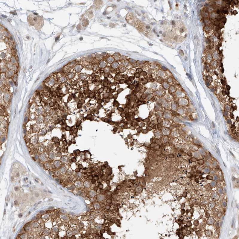 TASP1 Antibody - BSA Free Immunohistochemistry-Paraffin: TASP1 Antibody - BSA Free [NBP1-88306]