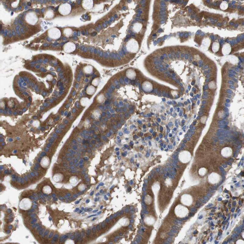 DDRGK1 Antibody - BSA Free Immunohistochemistry-Paraffin: DDRGK1 Antibody - BSA Free [NBP1-88308]