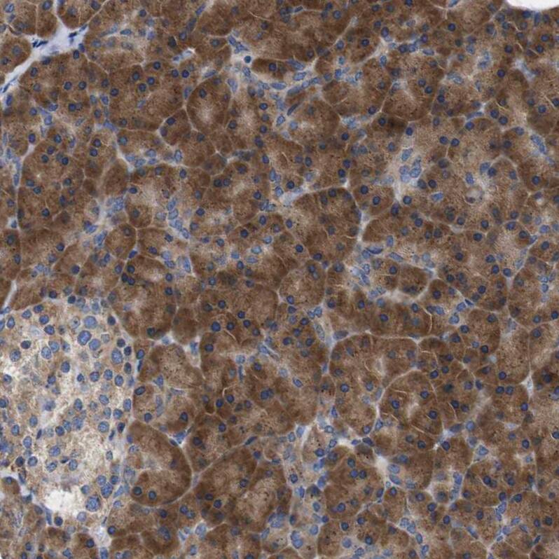 DDRGK1 Antibody - BSA Free Immunohistochemistry-Paraffin: DDRGK1 Antibody - BSA Free [NBP1-88308]
