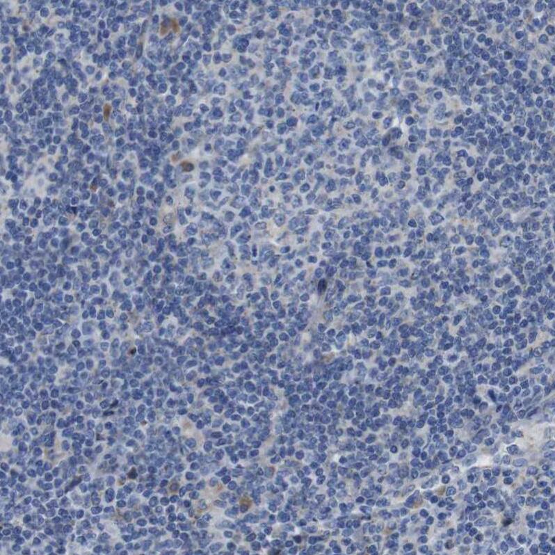 DDRGK1 Antibody - BSA Free Immunohistochemistry-Paraffin: DDRGK1 Antibody - BSA Free [NBP1-88308]