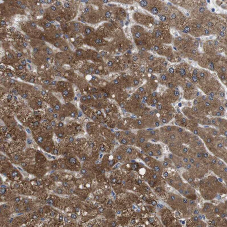 DDRGK1 Antibody - BSA Free Immunohistochemistry-Paraffin: DDRGK1 Antibody - BSA Free [NBP1-88308]