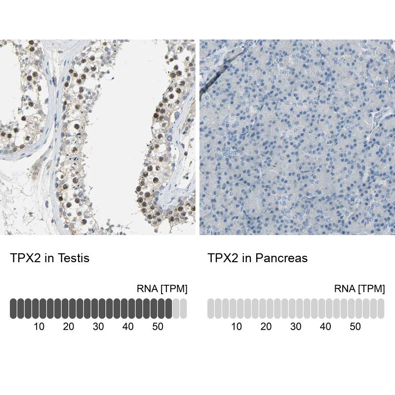 TPX2 Antibody - BSA Free Immunohistochemistry-Paraffin: TPX2 Antibody - BSA Free [NBP1-88312]