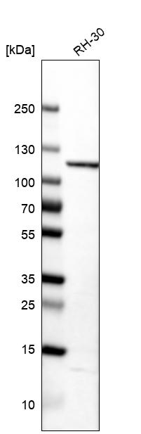 TPX2 Antibody - BSA Free Western Blot: TPX2 Antibody - BSA Free [NBP1-88312]