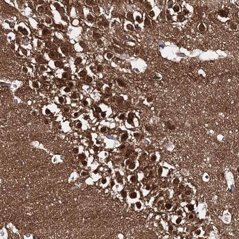 CAPRIN2 Antibody - BSA Free Immunohistochemistry-Paraffin: CAPRIN2 Antibody [NBP1-88318]
