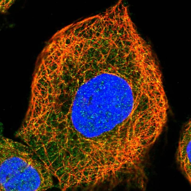 AIDA Antibody - BSA Free Immunocytochemistry/ Immunofluorescence: AIDA Antibody [NBP1-88323]