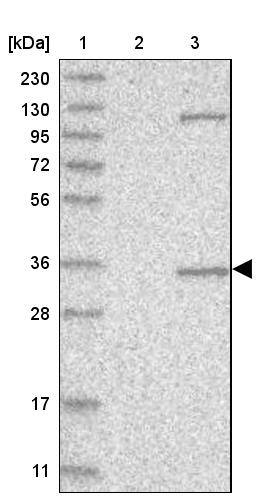 AIDA Antibody - BSA Free Western Blot: AIDA Antibody - BSA Free [NBP1-88323]