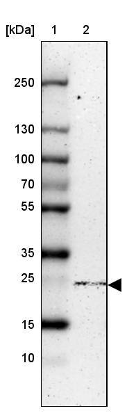 NTPCR Antibody - BSA Free Western Blot: NTPCR Antibody - BSA Free [NBP1-88331]
