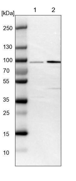 FAM189B Antibody - BSA Free Western Blot: FAM189B Antibody - BSA Free [NBP1-88343]