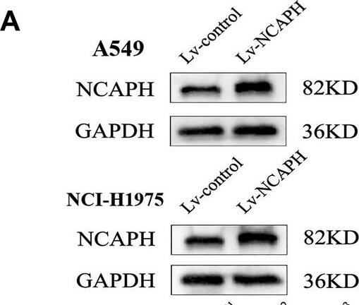 NCAPH Antibody - BSA Free