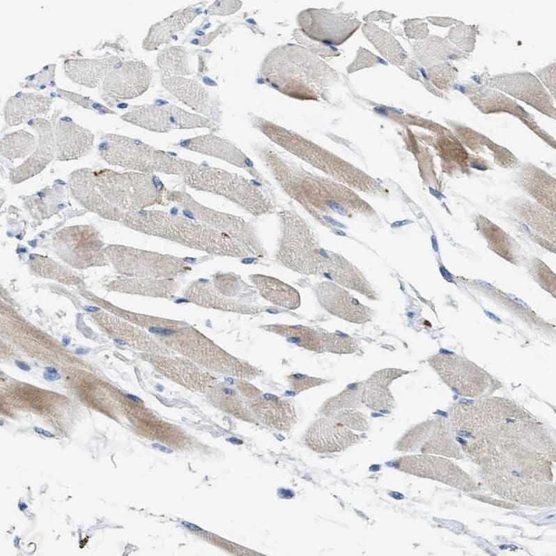 PNKD Antibody - BSA Free Immunohistochemistry-Paraffin: PNKD Antibody - BSA Free [NBP1-88348]