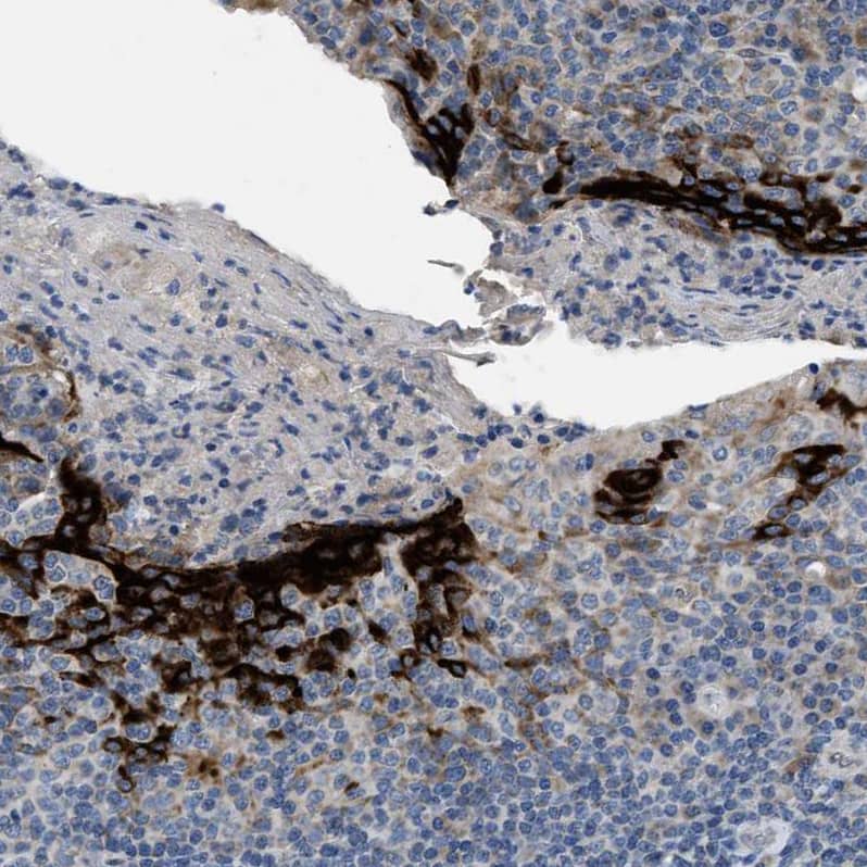 PNKD Antibody - BSA Free Immunohistochemistry-Paraffin: PNKD Antibody - BSA Free [NBP1-88348]