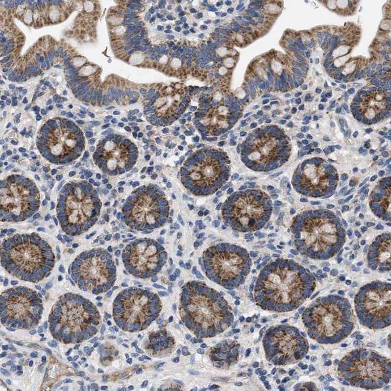 PNKD Antibody - BSA Free Immunohistochemistry-Paraffin: PNKD Antibody - BSA Free [NBP1-88348]