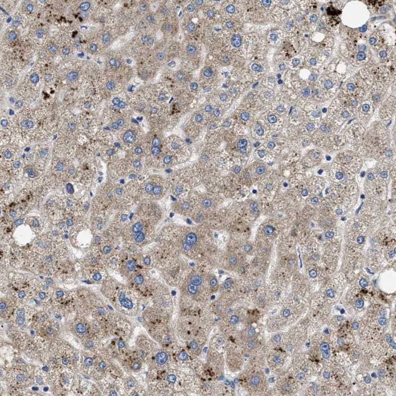 PNKD Antibody - BSA Free Immunohistochemistry-Paraffin: PNKD Antibody - BSA Free [NBP1-88348]