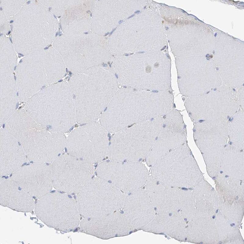ITM2B Antibody - BSA Free Immunohistochemistry-Paraffin: ITM2B Antibody [NBP1-88354]
