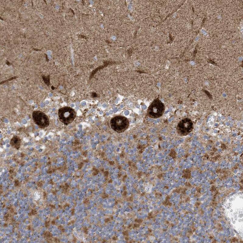 ITM2B Antibody - BSA Free Immunohistochemistry-Paraffin: ITM2B Antibody [NBP1-88354]
