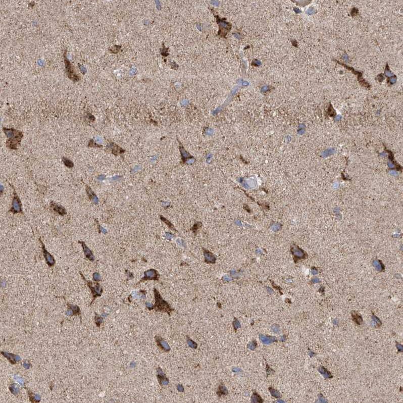 ITM2B Antibody - BSA Free Immunohistochemistry-Paraffin: ITM2B Antibody [NBP1-88354]