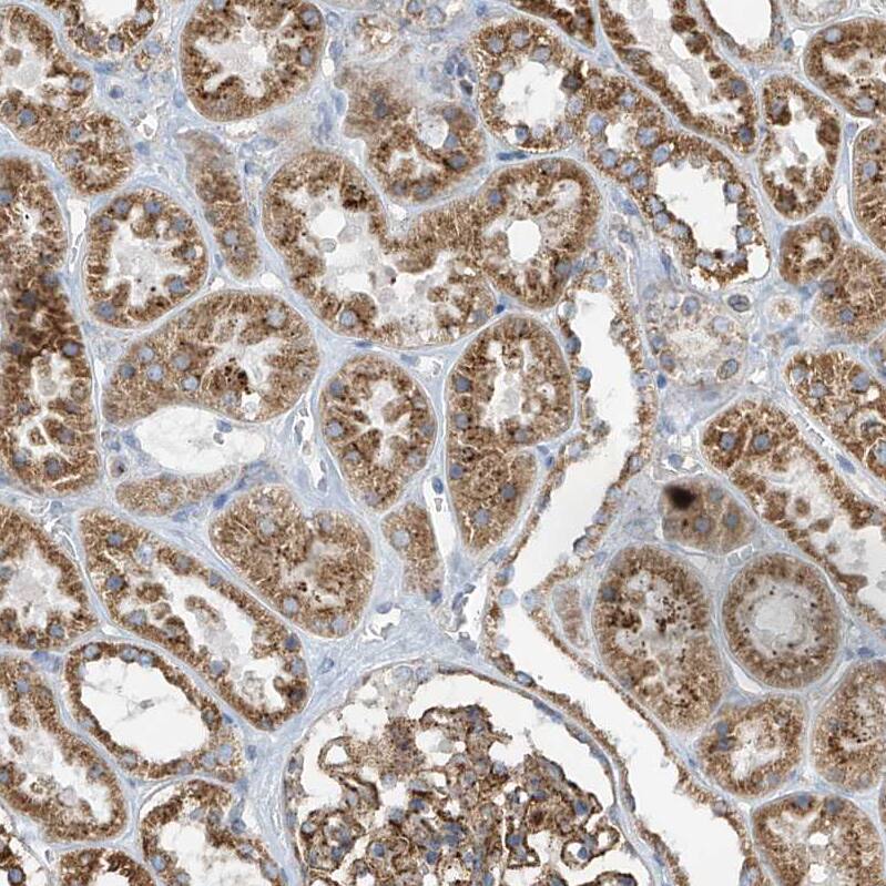ITM2B Antibody - BSA Free Immunohistochemistry-Paraffin: ITM2B Antibody [NBP1-88354]