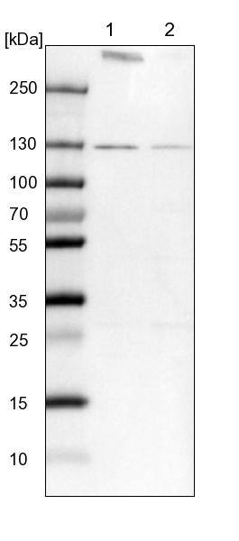 RNF40 Antibody - BSA Free Western Blot: RNF40 Antibody - BSA Free [NBP1-88356]