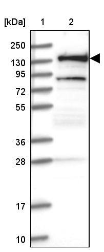 RNF40 Antibody - BSA Free Western Blot: RNF40 Antibody - BSA Free [NBP1-88356]
