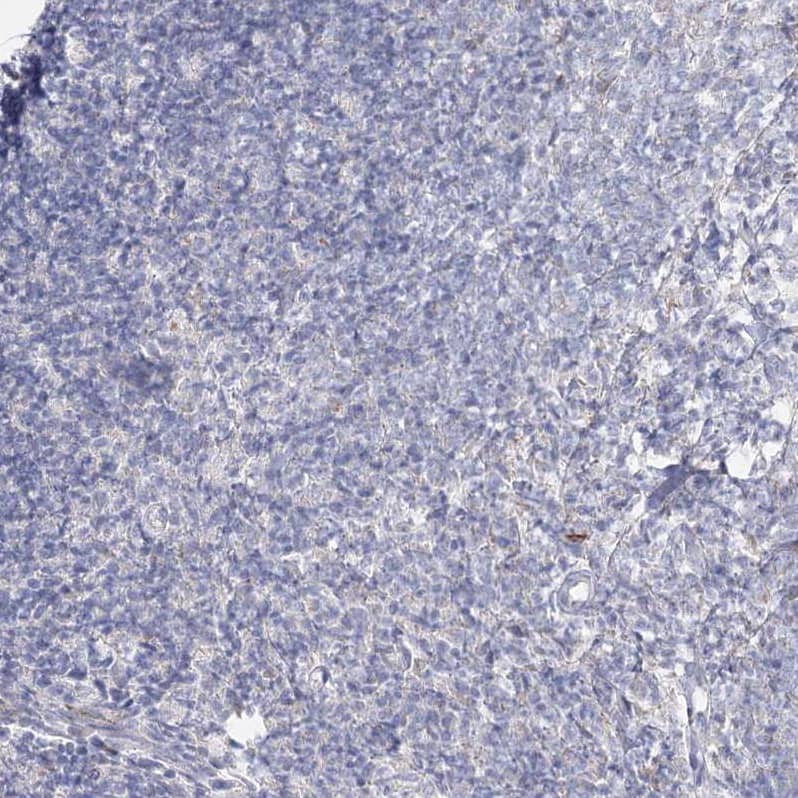 ACOX2 Antibody - BSA Free Immunohistochemistry-Paraffin: ACOX2 Antibody - BSA Free [NBP1-88364]