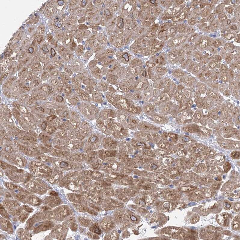 ACOX2 Antibody - BSA Free Immunohistochemistry-Paraffin: ACOX2 Antibody - BSA Free [NBP1-88364]