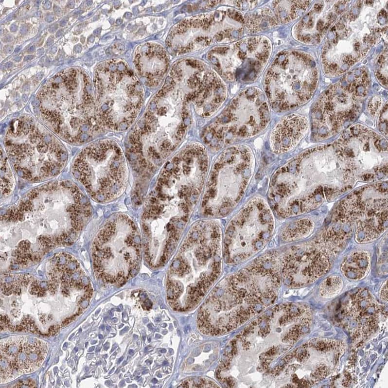 ACOX2 Antibody - BSA Free Immunohistochemistry-Paraffin: ACOX2 Antibody - BSA Free [NBP1-88364]