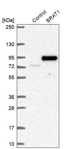 BAAT1 Antibody - BSA Free Western Blot: BAAT1 Antibody - BSA Free [NBP1-88366]