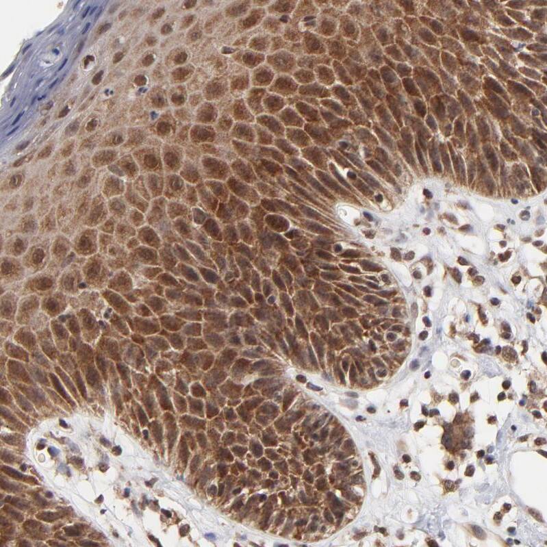 BRPF1 Antibody - BSA Free Immunohistochemistry-Paraffin: BRPF1 Antibody - BSA Free [NBP1-88369]