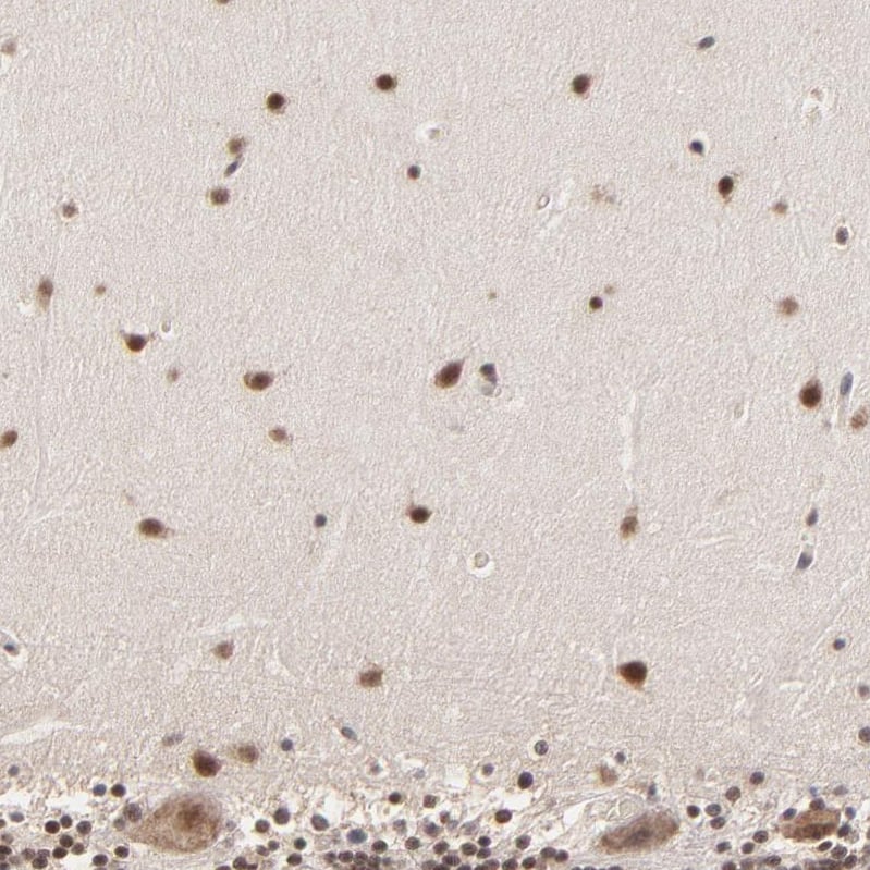 BRPF1 Antibody - BSA Free Immunohistochemistry-Paraffin: BRPF1 Antibody - BSA Free [NBP1-88369]