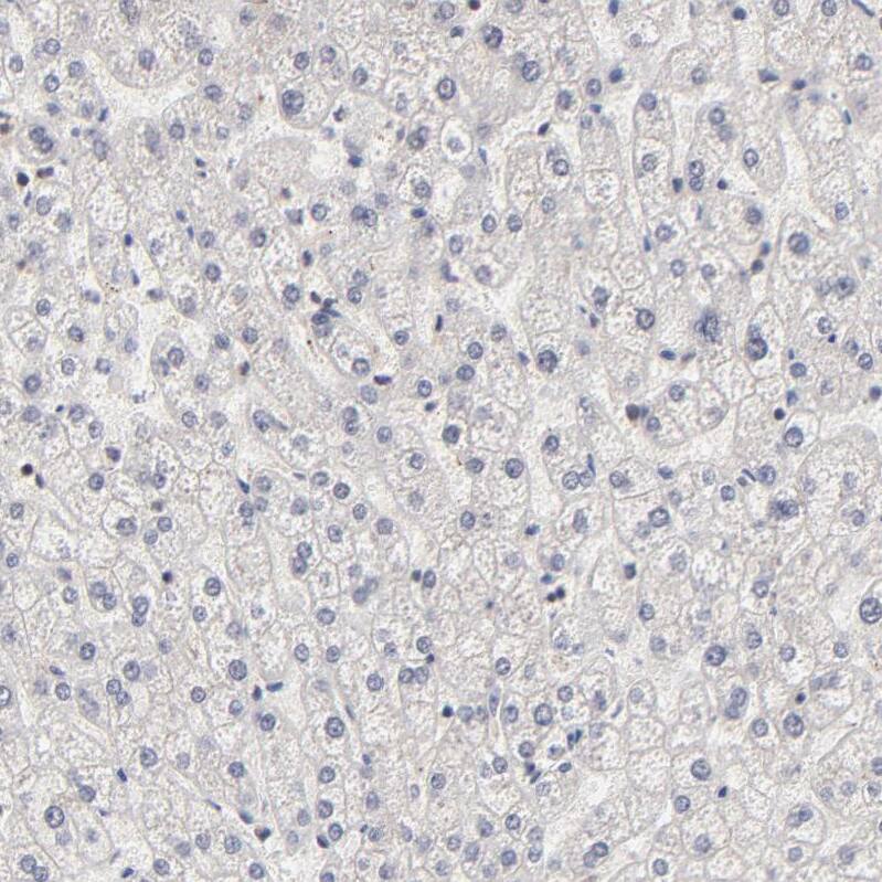 BRPF1 Antibody - BSA Free Immunohistochemistry-Paraffin: BRPF1 Antibody - BSA Free [NBP1-88369]