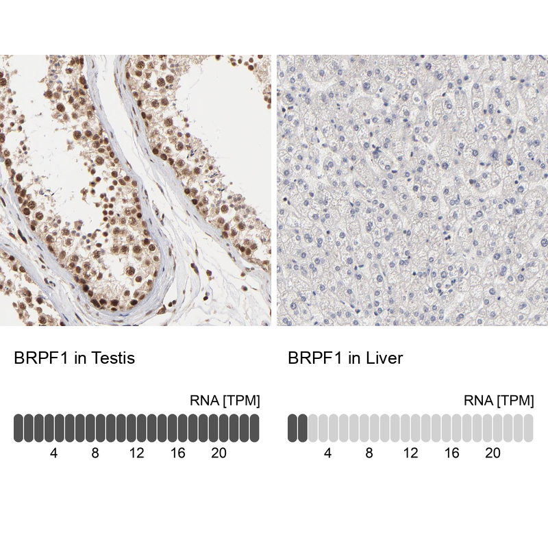 BRPF1 Antibody - BSA Free Immunohistochemistry-Paraffin: BRPF1 Antibody - BSA Free [NBP1-88369]