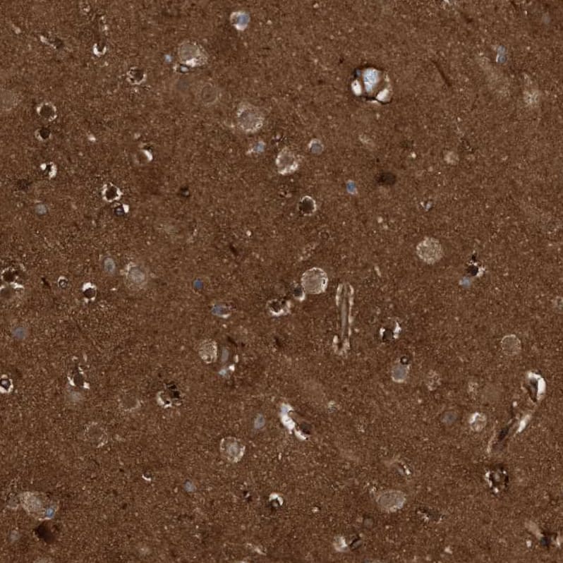 CDC42EP4 Antibody - BSA Free Immunohistochemistry-Paraffin: CDC42EP4 Antibody - BSA Free [NBP1-88380]