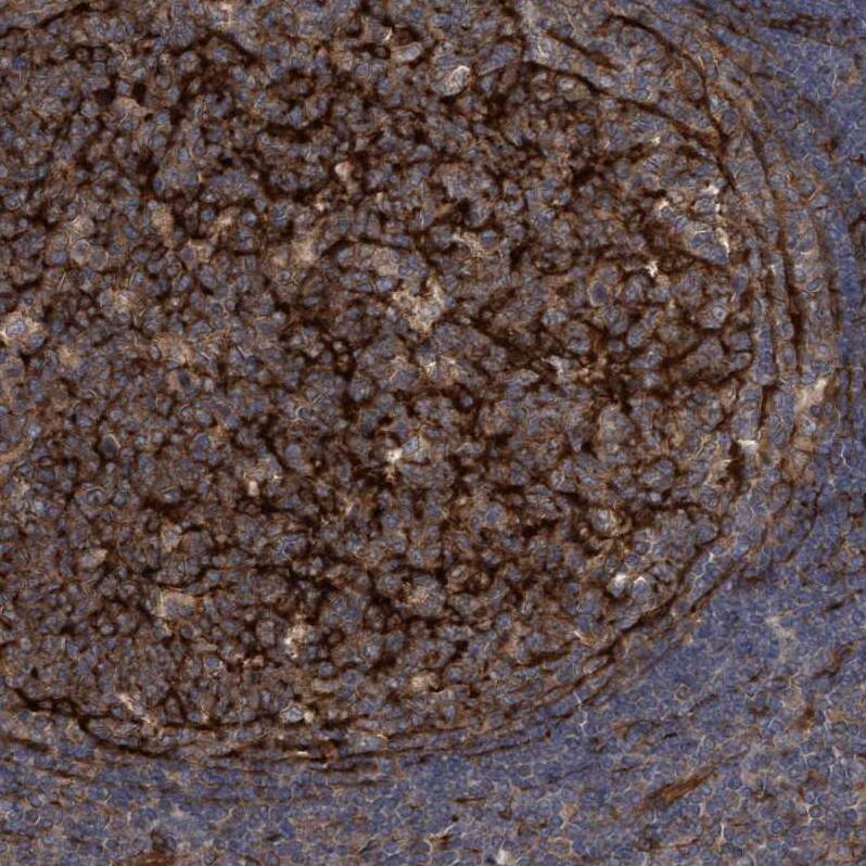 CDC42EP4 Antibody - BSA Free Immunohistochemistry-Paraffin: CDC42EP4 Antibody - BSA Free [NBP1-88380]