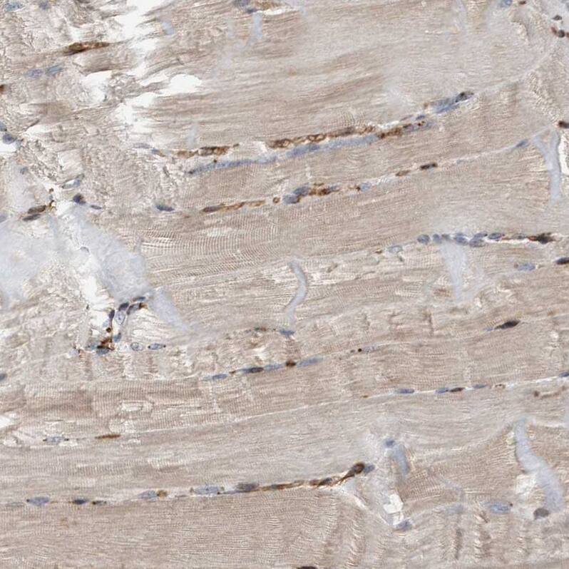 CDC42EP4 Antibody - BSA Free Immunohistochemistry-Paraffin: CDC42EP4 Antibody - BSA Free [NBP1-88380]