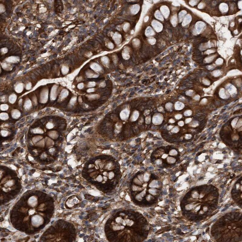 CDC42EP4 Antibody - BSA Free Immunohistochemistry-Paraffin: CDC42EP4 Antibody - BSA Free [NBP1-88380]