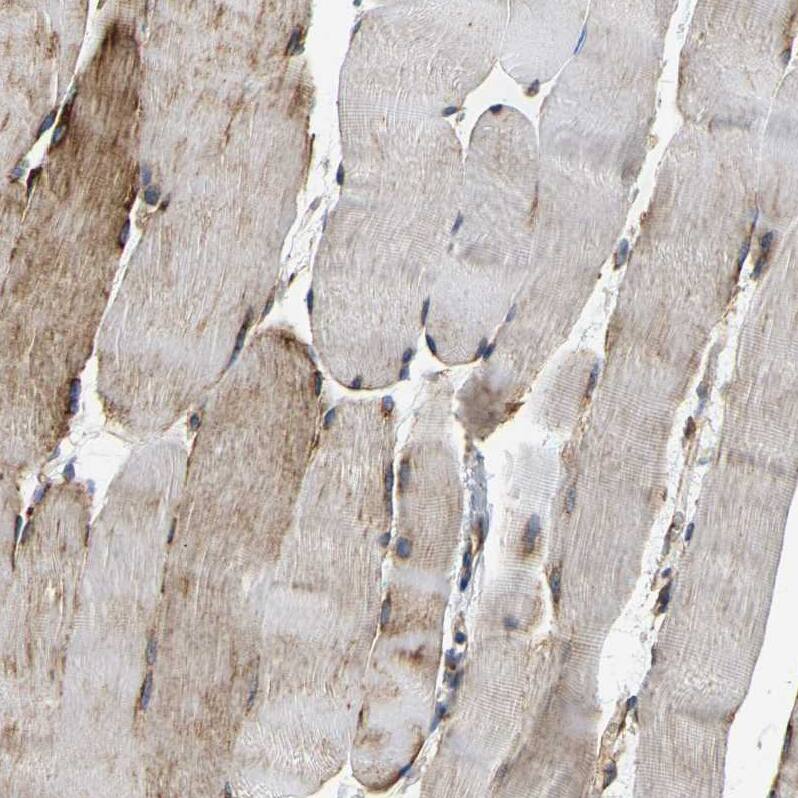 DUSP8 Antibody - BSA Free Immunohistochemistry-Paraffin: DUSP8 Antibody - BSA Free [NBP1-88385]