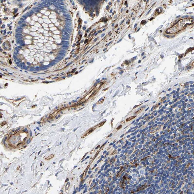DUSP8 Antibody - BSA Free Immunohistochemistry-Paraffin: DUSP8 Antibody - BSA Free [NBP1-88385]