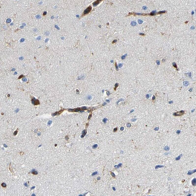 DUSP8 Antibody - BSA Free Immunohistochemistry-Paraffin: DUSP8 Antibody - BSA Free [NBP1-88385]