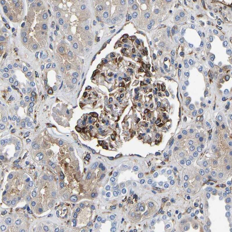 DUSP8 Antibody - BSA Free Immunohistochemistry-Paraffin: DUSP8 Antibody - BSA Free [NBP1-88385]