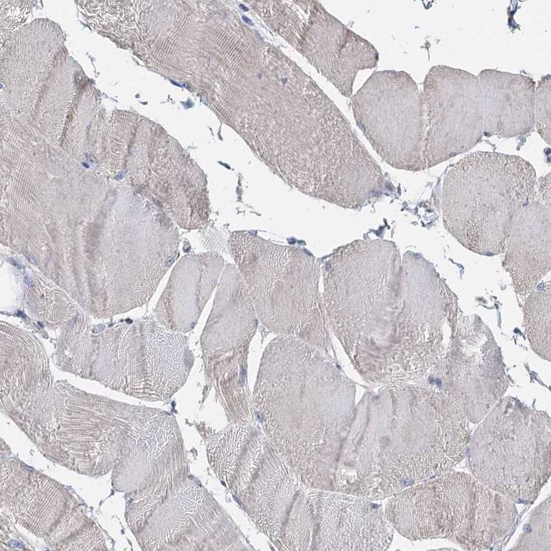 TCTN2 Antibody - BSA Free Immunohistochemistry-Paraffin: TCTN2 Antibody [NBP1-88392]