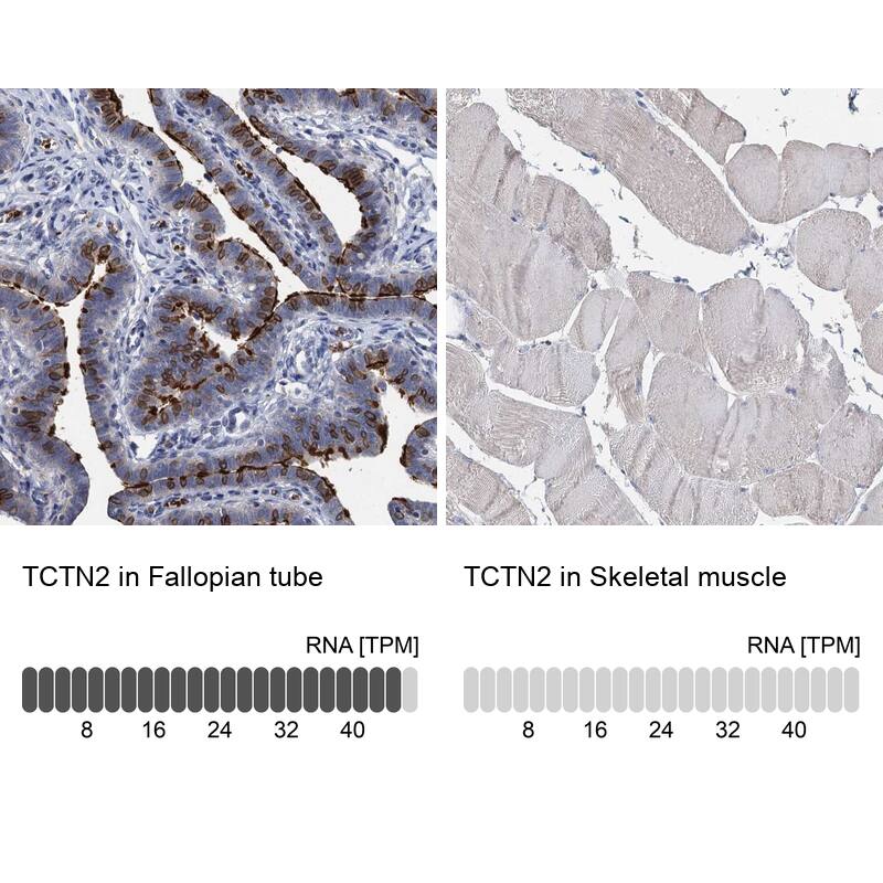 TCTN2 Antibody - BSA Free Immunohistochemistry-Paraffin: TCTN2 Antibody [NBP1-88392]
