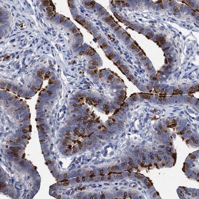 TCTN2 Antibody - BSA Free Immunohistochemistry-Paraffin: TCTN2 Antibody [NBP1-88392]