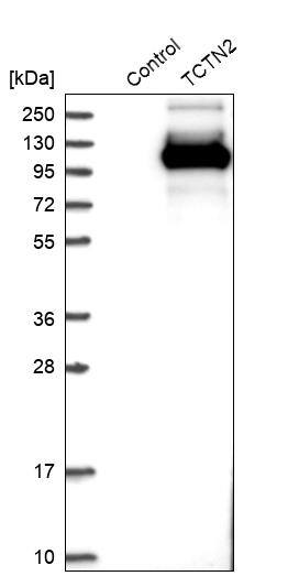 TCTN2 Antibody - BSA Free Western Blot: TCTN2 Antibody - BSA Free [NBP1-88392]