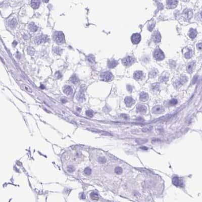 ERP27 Antibody - BSA Free Immunohistochemistry-Paraffin: ERP27 Antibody [NBP1-88393]