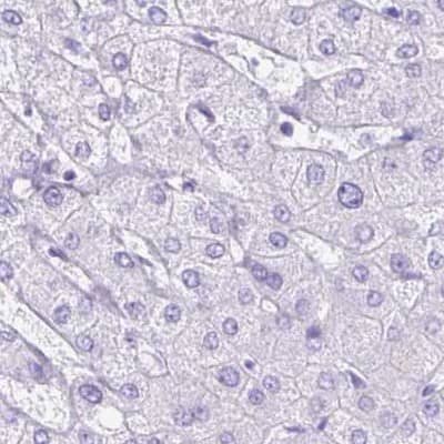 ERP27 Antibody - BSA Free Immunohistochemistry-Paraffin: ERP27 Antibody [NBP1-88393]